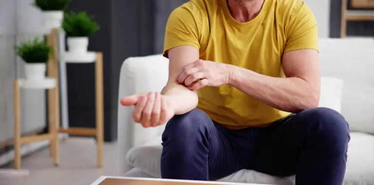 Nokkosihottuma eli urtikaria